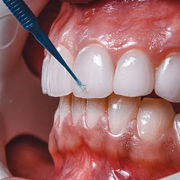 shiny vibe - דף נחיתה