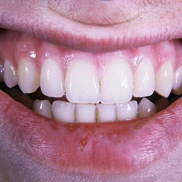 shiny vibe - דף נחיתה