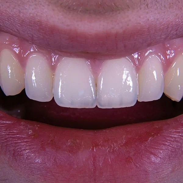 shiny vibe - דף נחיתה