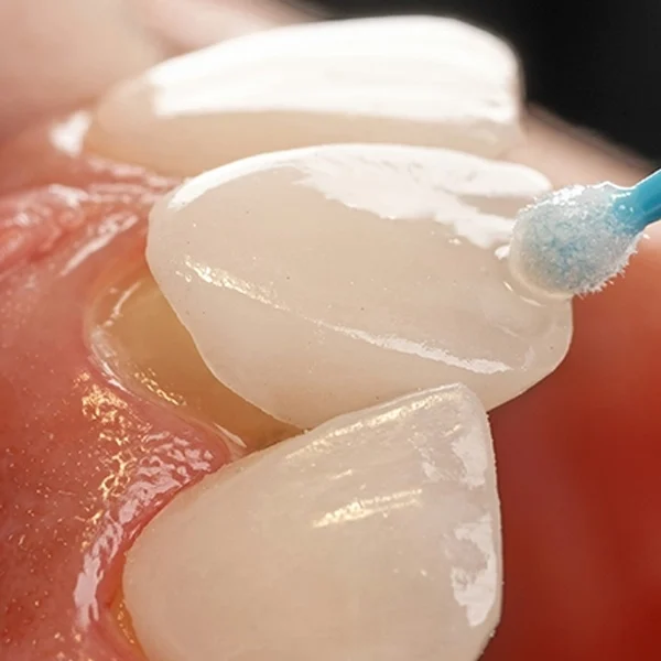 shiny vibe - דף נחיתה